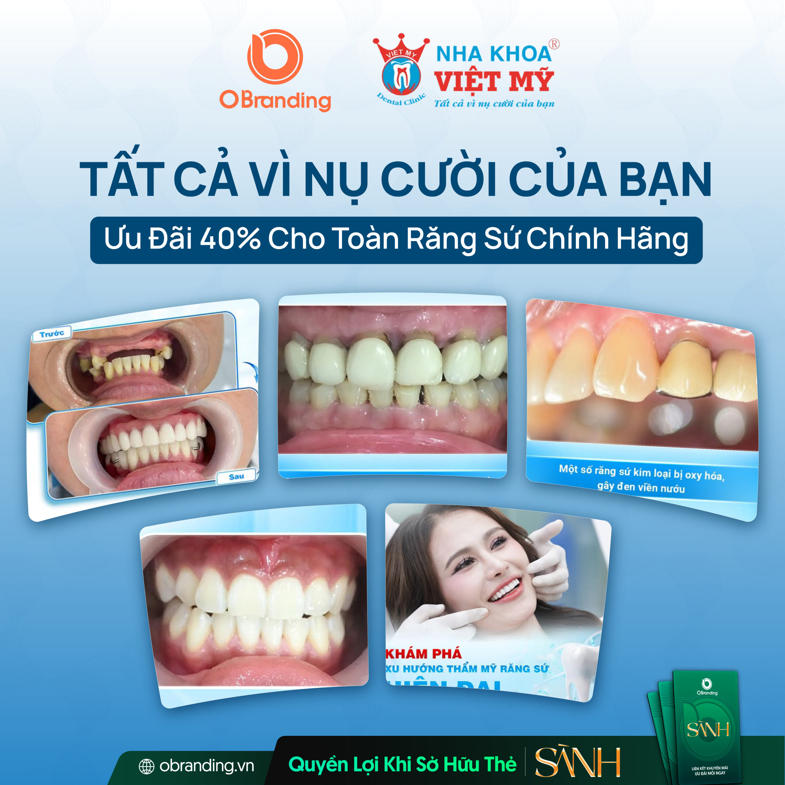 Ưu Đãi Dành Cho Hội Viên Thẻ SÀNH